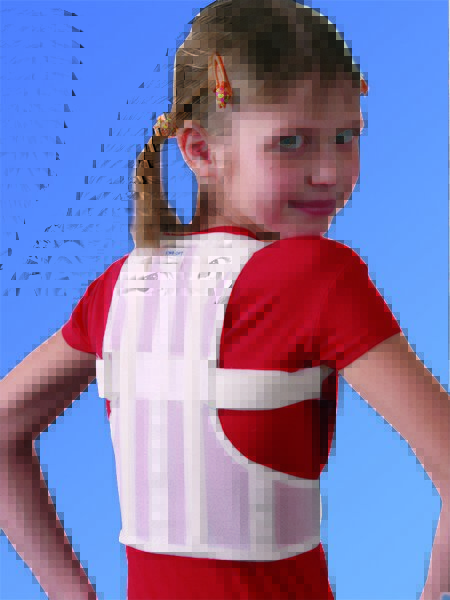Фиксаторы